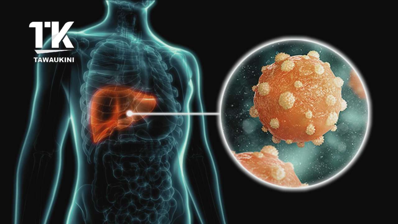 Statistik Kes Hepatitis di Malaysia